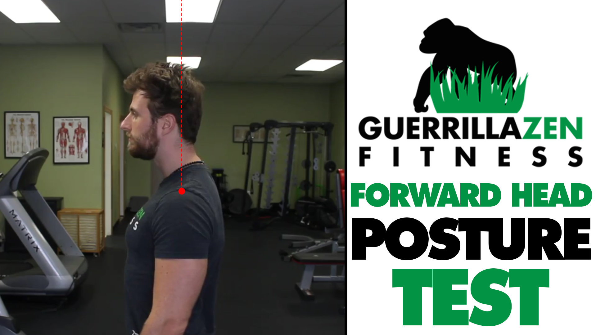 Forward Head Posture Test | Do you Have Forward Head Posture?