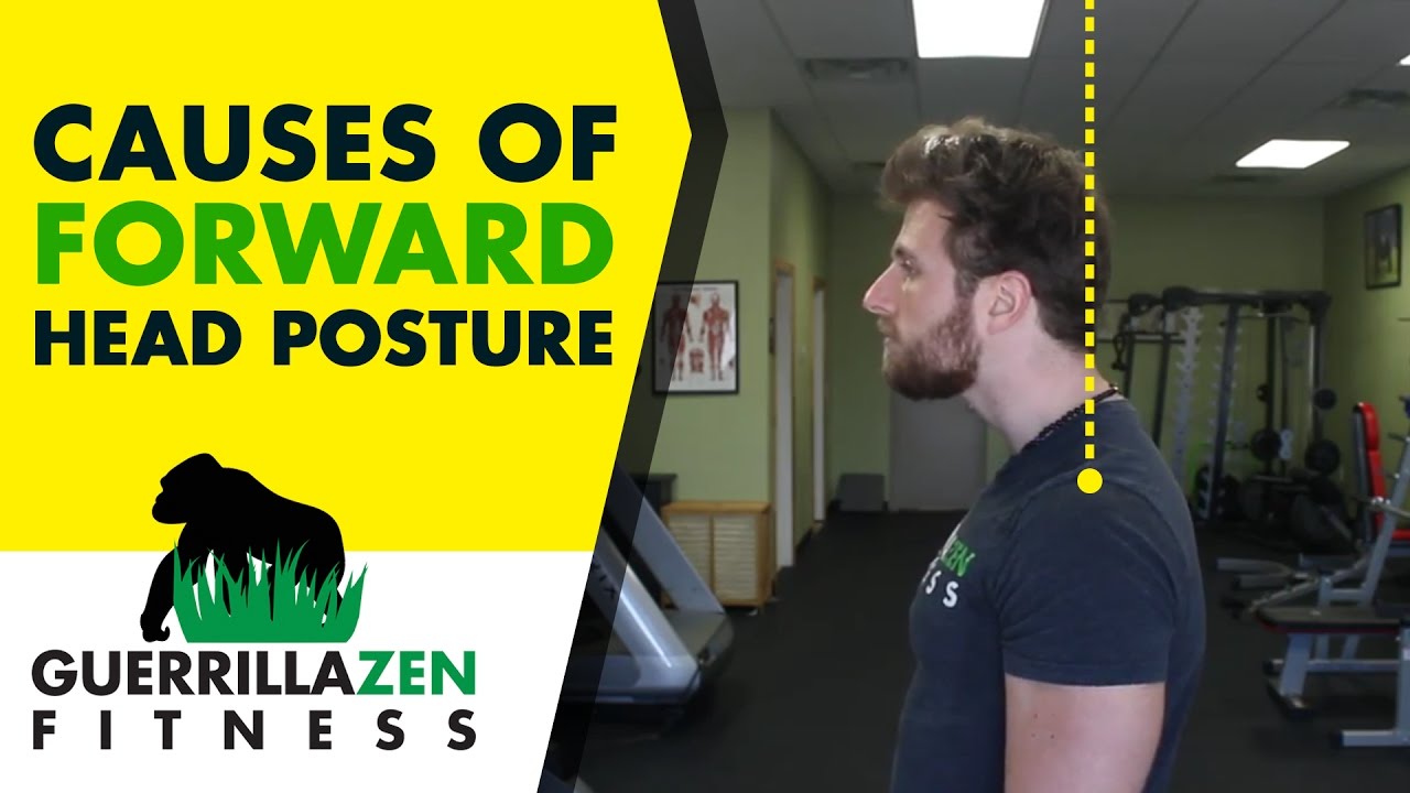 Forward Head Posture | 3 BIGGEST Causes of Vulture Neck!