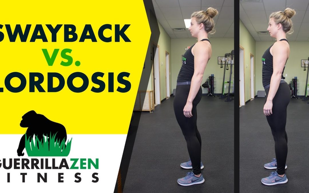 Swayback vs. Anterior Pelvic Tilt (w/ Lordosis)