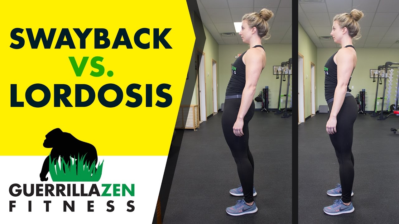 Anterior Pelvic Tilt and Swayback AT THE SAME TIME? | Here’s what to do!