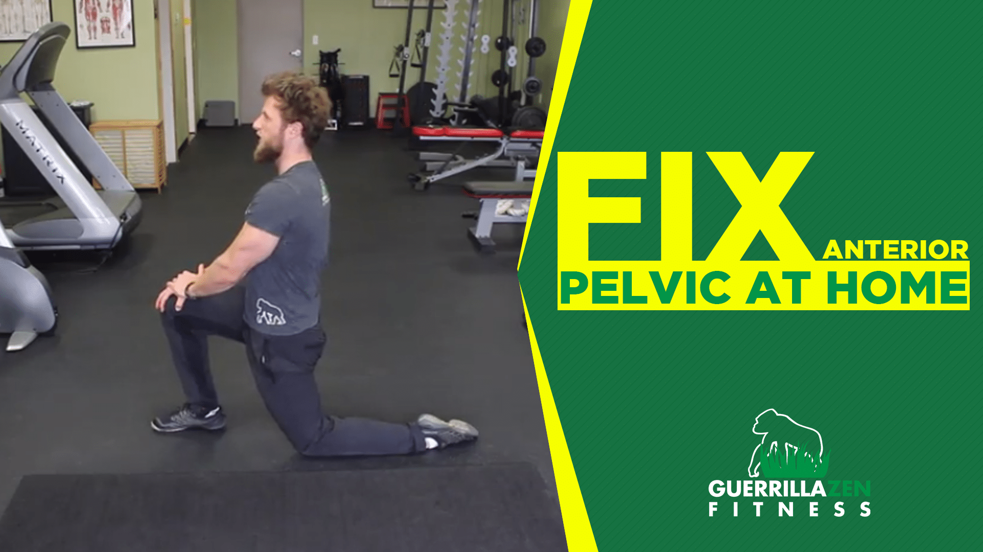 Anterior Pelvic Tilt Correction | Do These AT HOME!