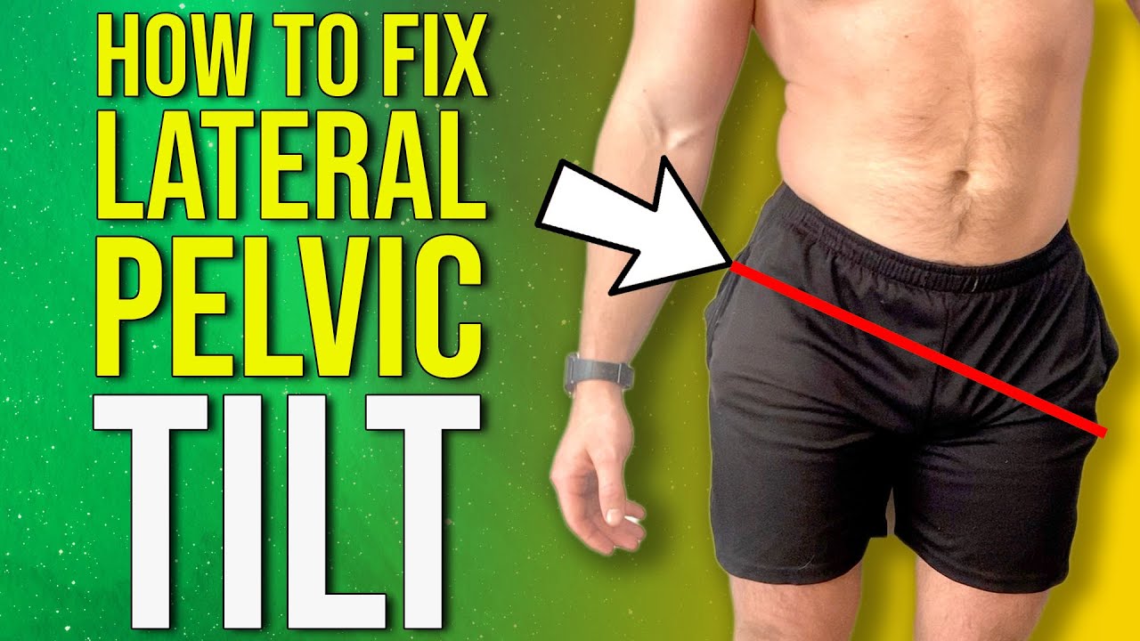 How to Fix Uneven Hips | Lateral Pelvic Tilt Correction Exercises ...