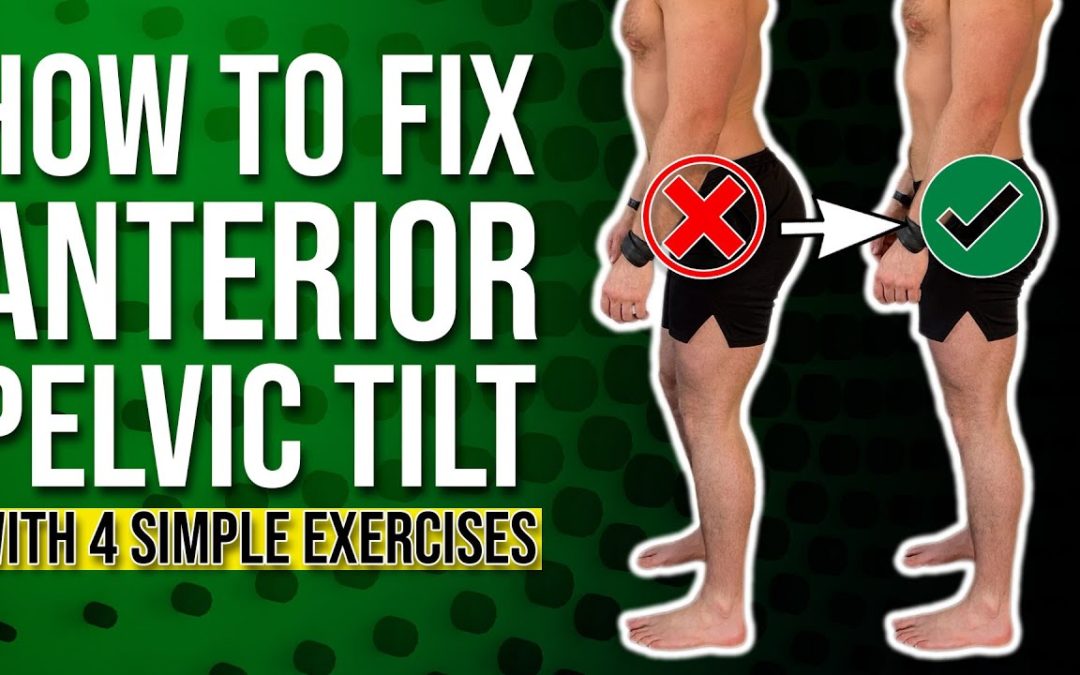 Anterior Pelvic Correction Exercises | The 4 BEST Ones You Can Do