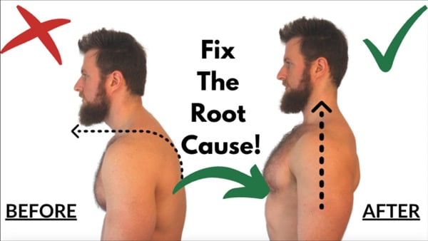 What Causes Forward Head Posture | It’s NOT what you think