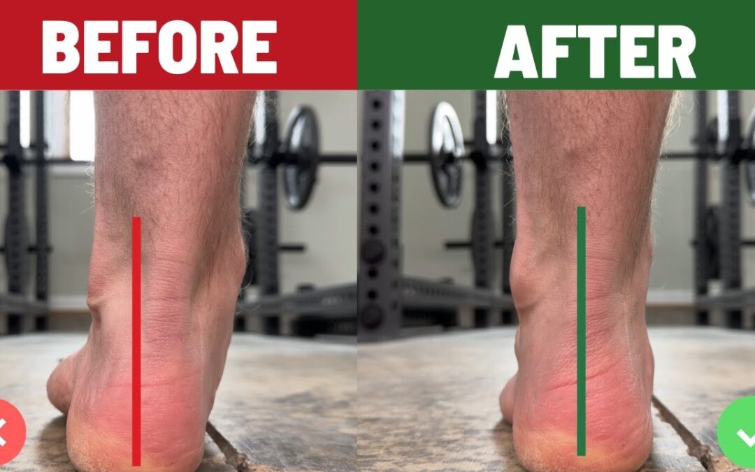 The Real Fix for Pronated Ankles (It’s NOT Just Arch Strength)