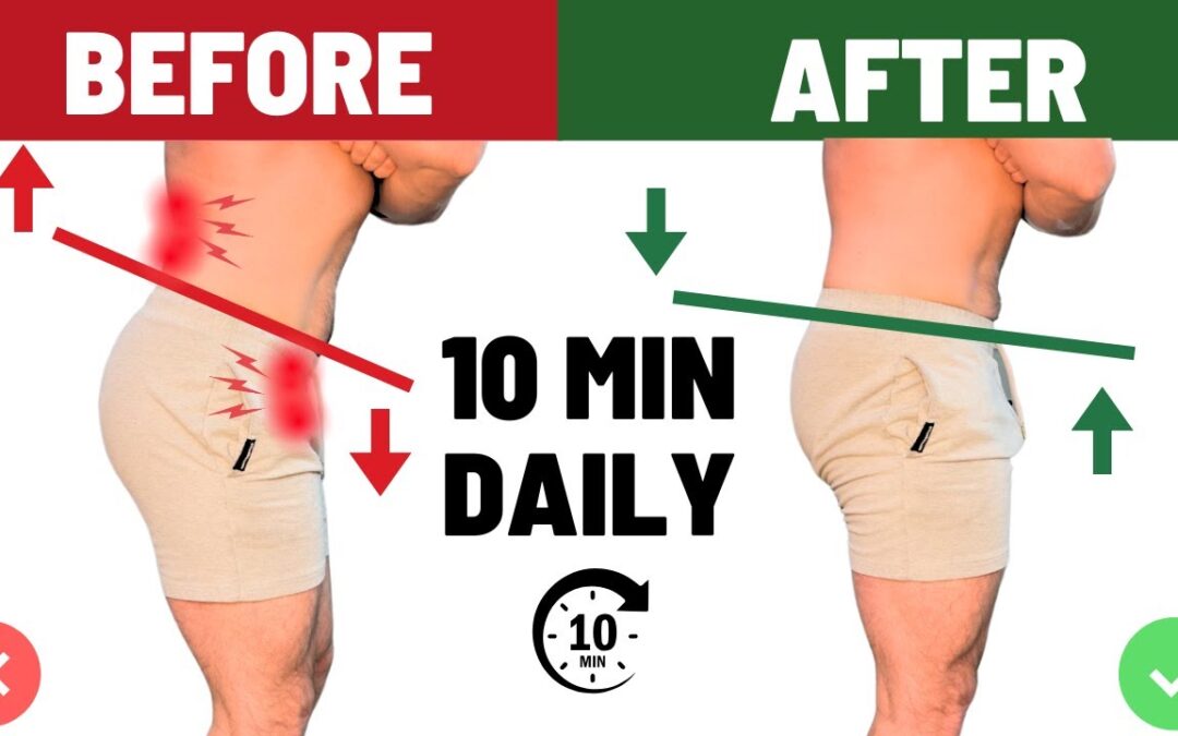 Anterior Pelvic Tilt Correction | The 3 Most Powerful Exercises To Fix it for GOOD!