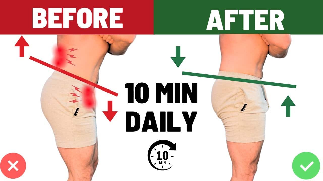 Anterior Pelvic Tilt Correction | The 3 Most Powerful Exercises To Fix it for GOOD!