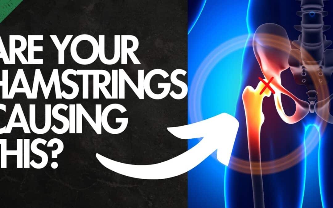 How To Fix Hip Pinching | FIX THE HAMSTRING DOMINANCE FIRST!