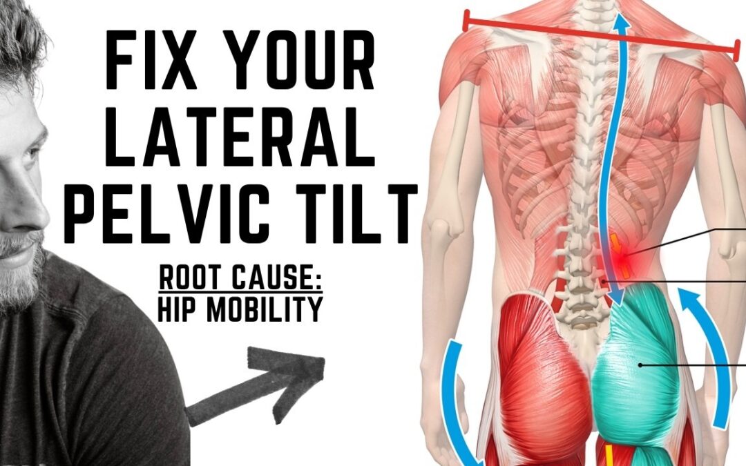 Struggling With Lateral Pelvic Tilt? Do THIS for Balance